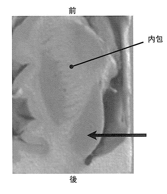 矢印で示す部位はどれか。