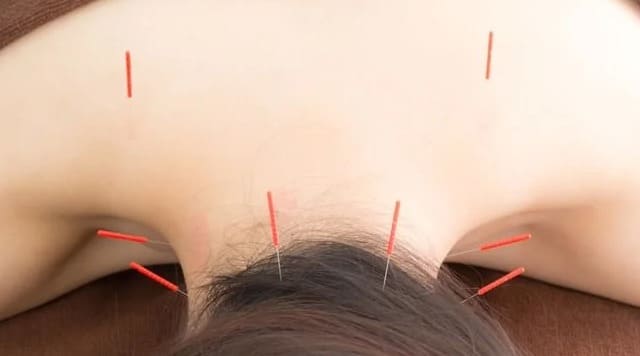 鍼灸師資格とは？取得までの流れを理解しよう